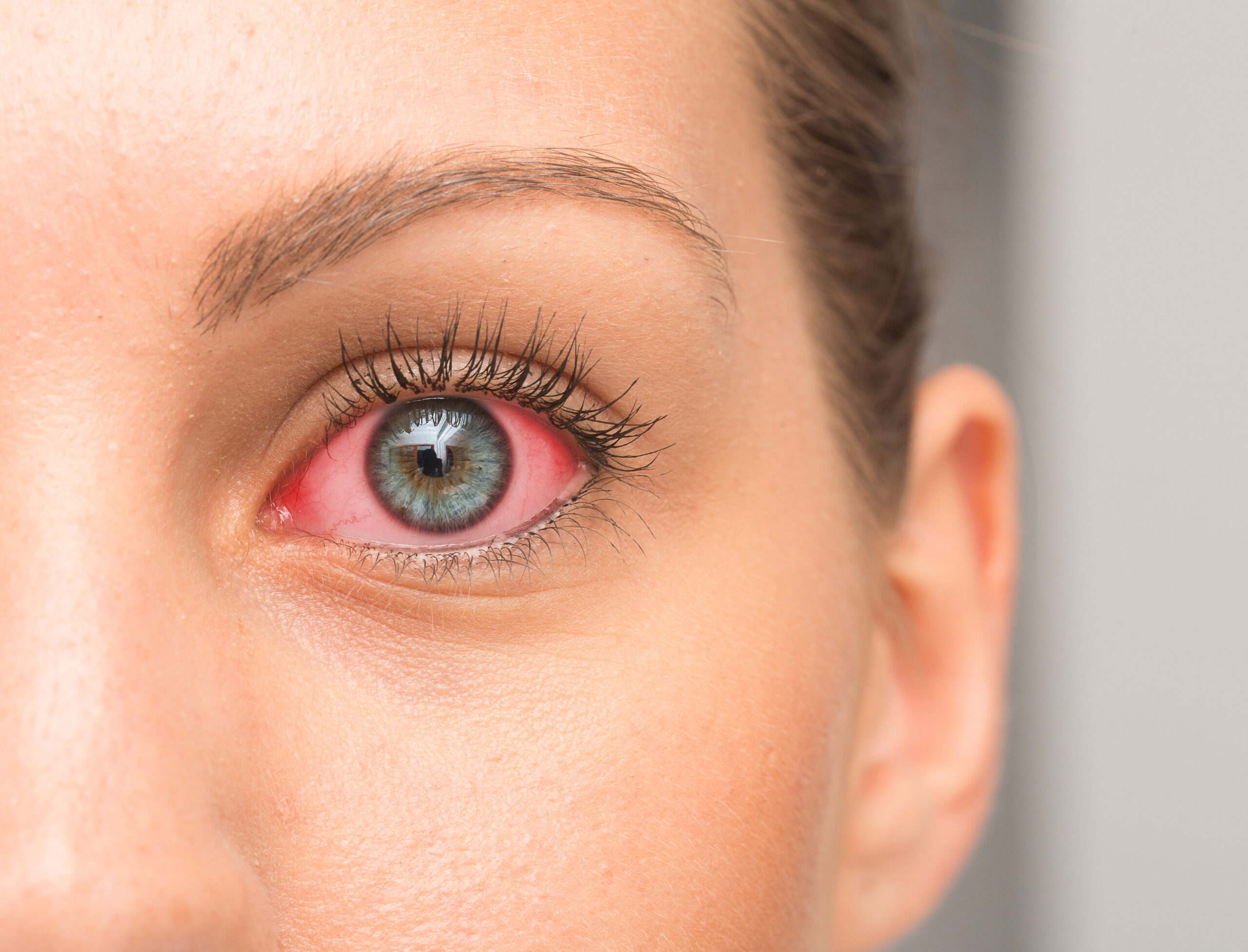 Rote Und Brennende Augen › Gesundheitsoptik 